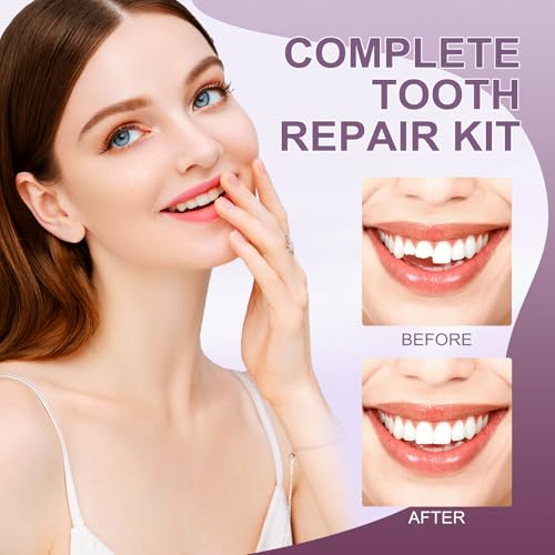 Tooth Repair kit，Teeth Repair Kit for Filling The Missing Broken Tooth and Gaps-Moldable Fake Teeth and Thermal Beads Temporary Replacement Kit-L002